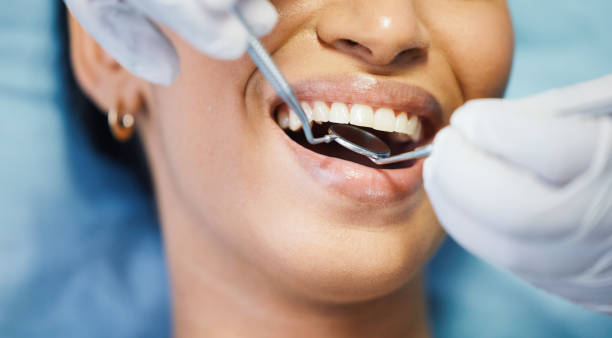 Best Broken or Chipped Tooth Repair in Rock Hill, MO