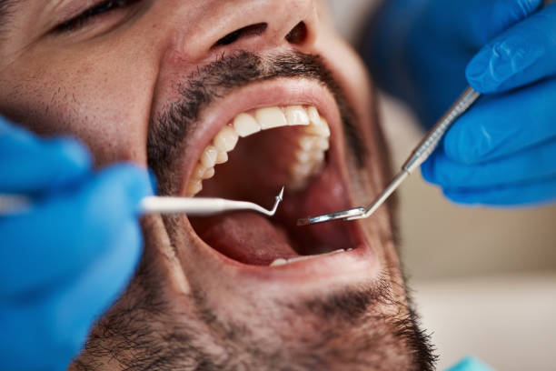 Best Emergency Care for Gum Disease in Rock Hill, MO